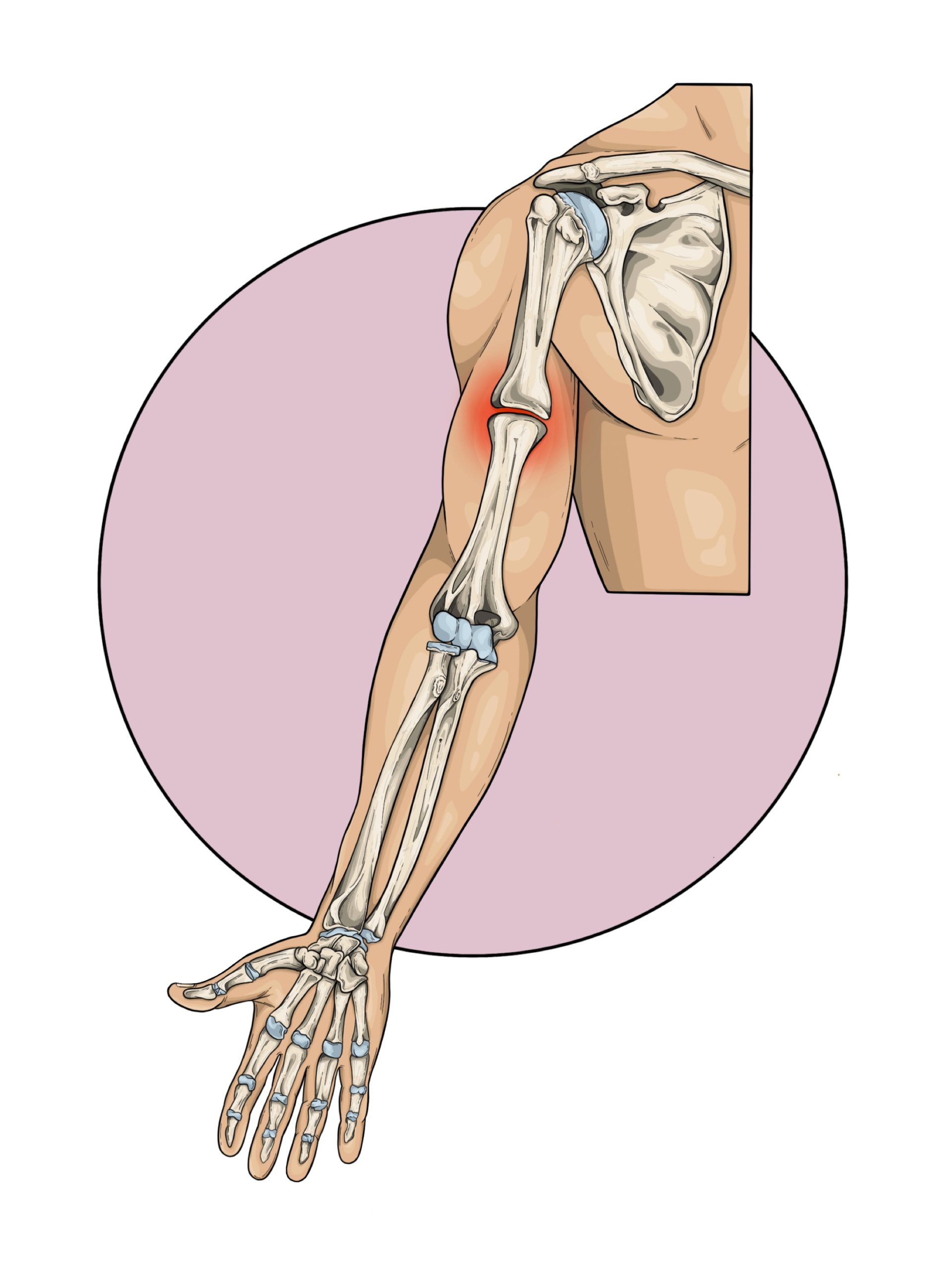 Ilustración de brazo humano.